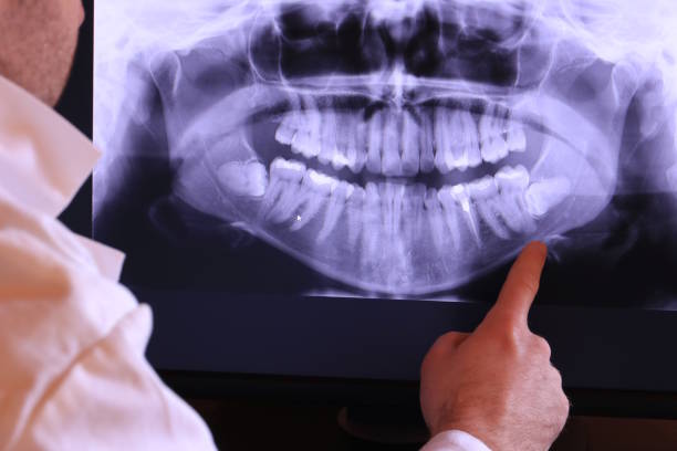 Best Dentist for Tooth Abscess  in Bunk Foss, WA
