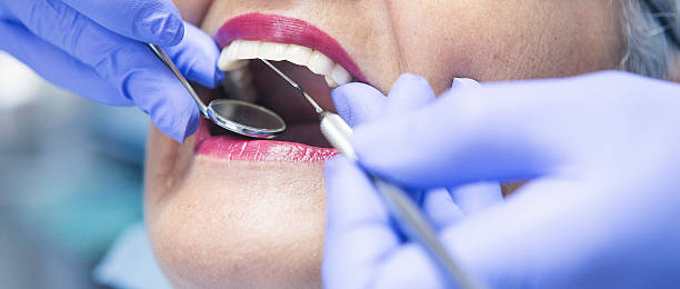 Best Urgent Tooth Repair  in Bunk Foss, WA